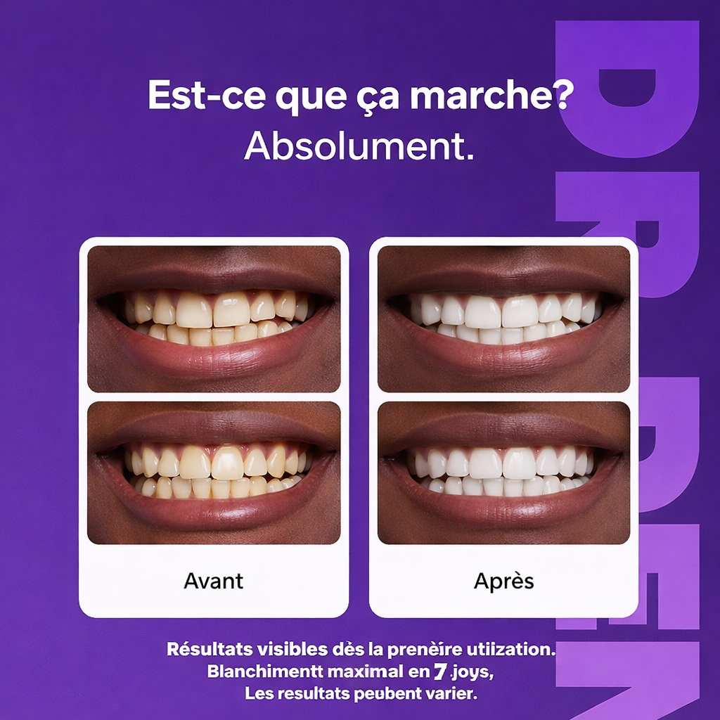 Kit de blanchiment dentaire – Sans peroxyde