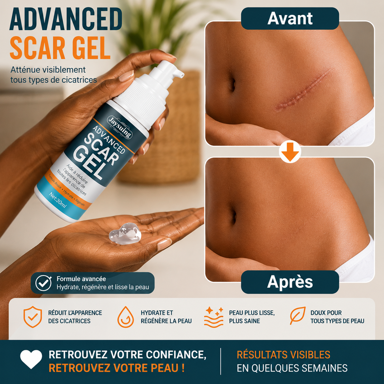 Scar Gel – Gel Anti-Cicatrices & Anti-Vergetures